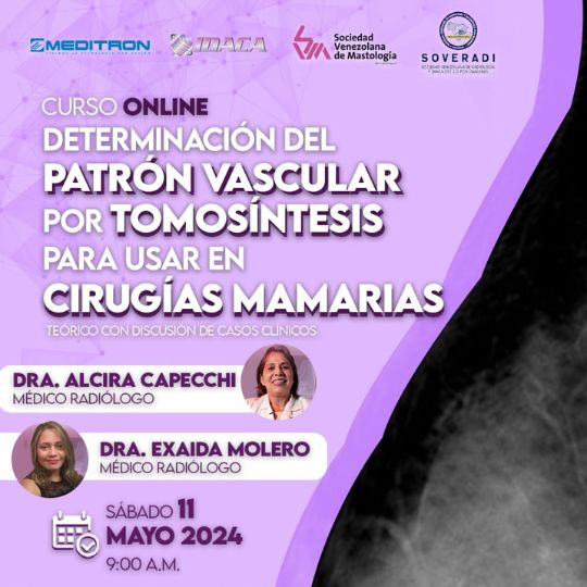 Determinación del Patrón Vascular por Tomosíntesis para Cirugías Mamarias – LICENCIADOS Y TECNICOS EN RADIOLOGÍA
